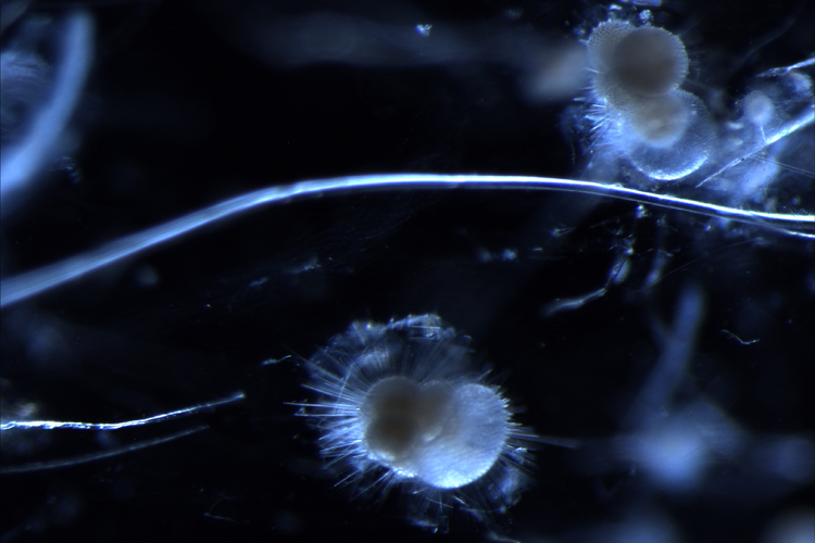 Foraminifera plankton from Okinawa with plastic strands