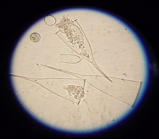 Plankton11