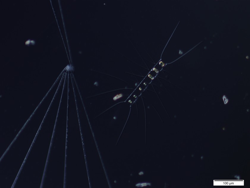 Radiolarian on the left and a Diatom on the right. Bay Villefranche Sur La Mer.