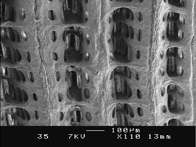 Scanning Electron Microscope Credits: Phd.Peter Benniger, Rozenn Cannuel Facultyof Science, University of Nantes, France.