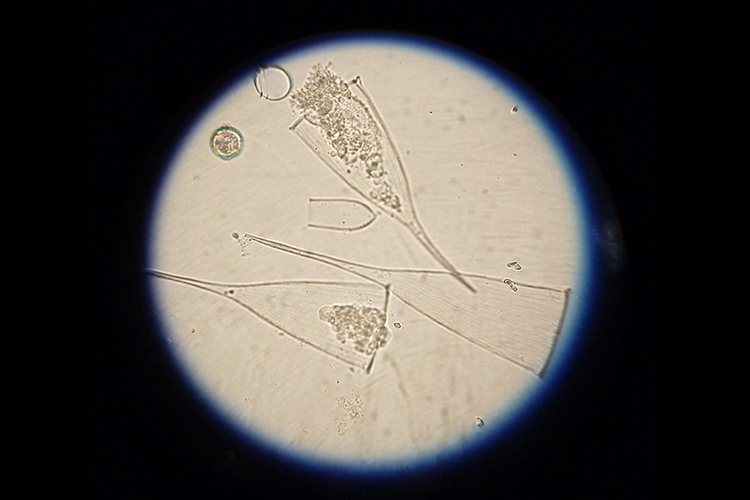 Tintinnid Plankton collected off coast of Chile