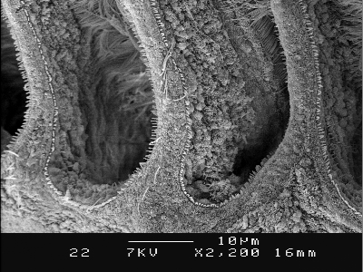 Scanning Electron Microscope Credits: Phd.Peter Benniger, Rozenn Cannuel Facultyof Science, University of Nantes, France.